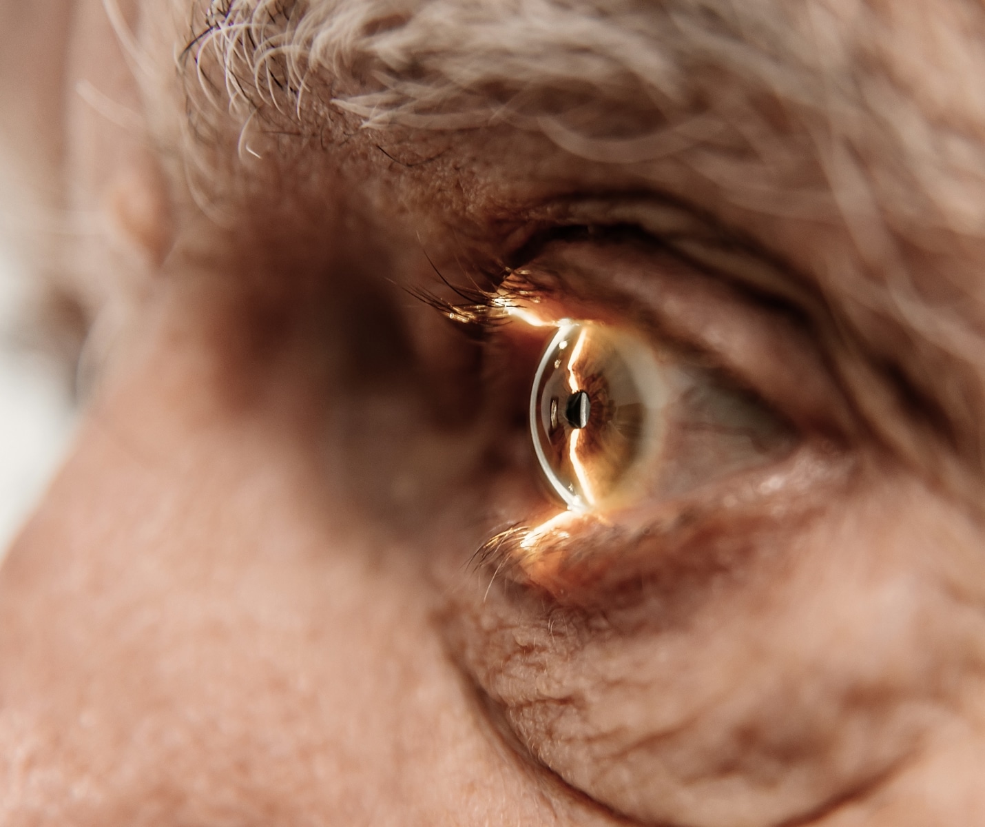 Soin par capsulotomie au laser YAG chez le Dr Hamelin-Gervais au Mans