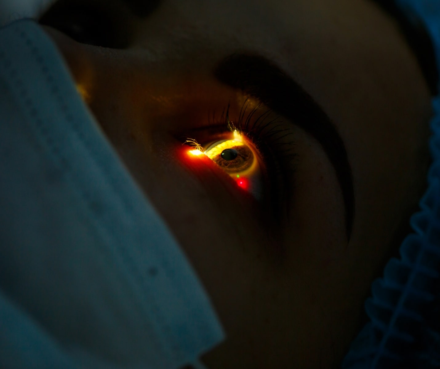 Correction de la vue par laser PKR chez le Dr Hamelin-Gervais au Mans